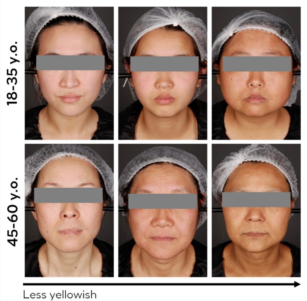欧莱雅 + 资生堂双研究揭秘皮肤发黄的分子机制