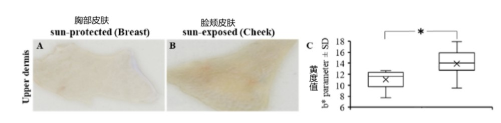 欧莱雅 + 资生堂双研究揭秘皮肤发黄的分子机制