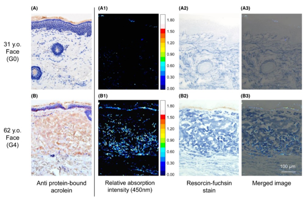 欧莱雅 + 资生堂双研究揭秘皮肤发黄的分子机制