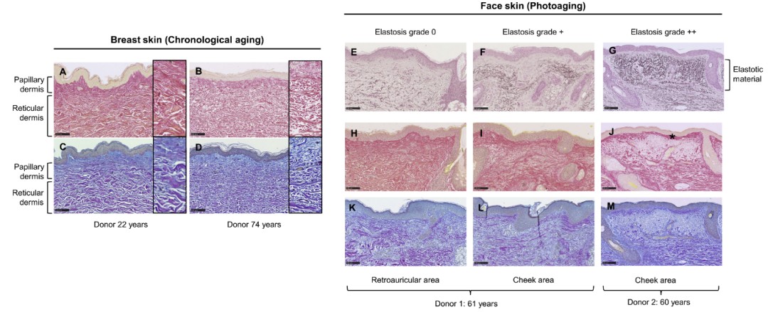欧莱雅综述皮肤“胶原密码”：从青春肌理到衰老印记的科学透视