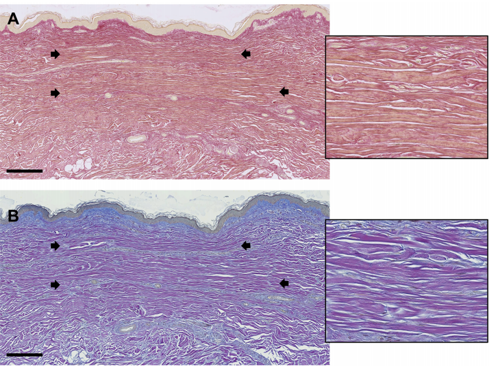 欧莱雅综述皮肤“胶原密码”：从青春肌理到衰老印记的科学透视