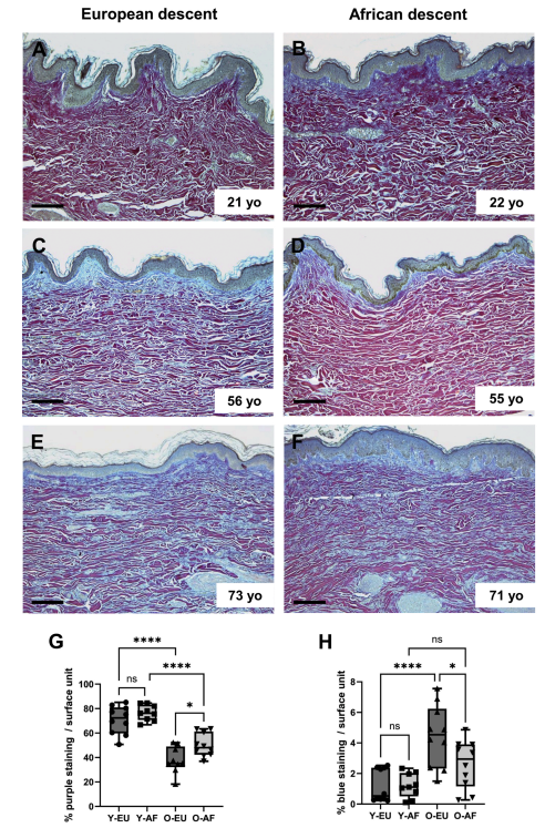 欧莱雅综述皮肤“胶原密码”：从青春肌理到衰老印记的科学透视