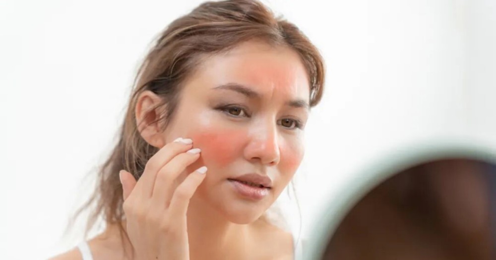 巨微首发｜Hydro-OK 肌愈，微循环修护新势力